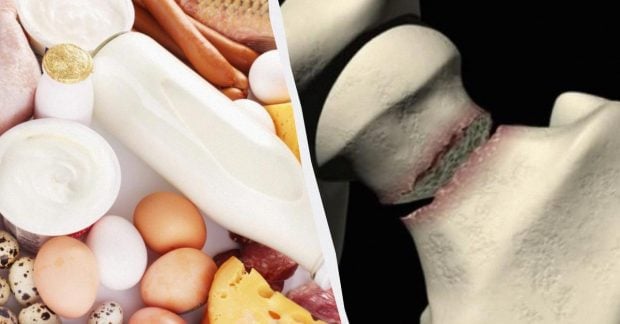 Makanan Sehari-hari yang Membantu Menjaga Kepadatan Tulang